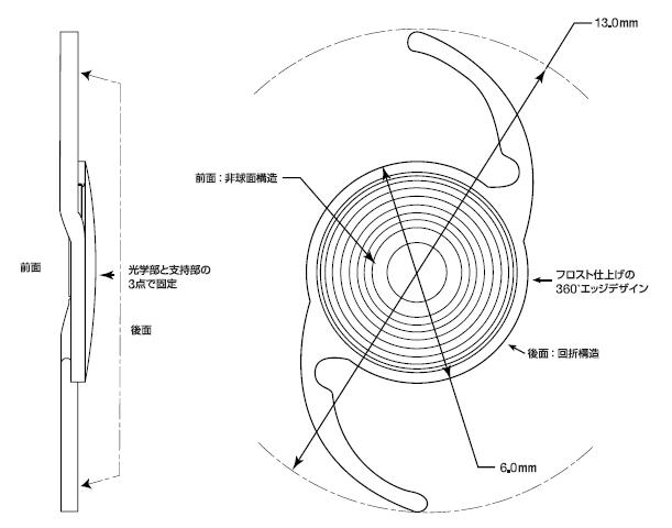 多焦点眼内レンズの構造