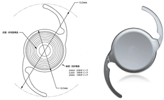 白内障と多焦点眼内レンズ